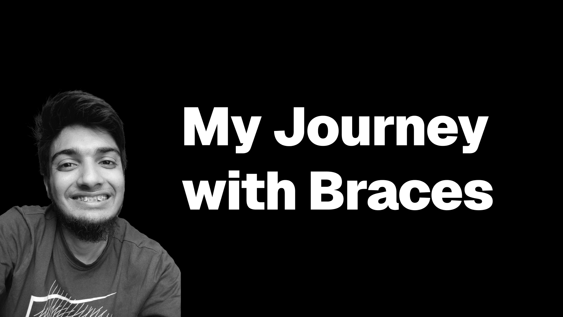 My Journey with Braces